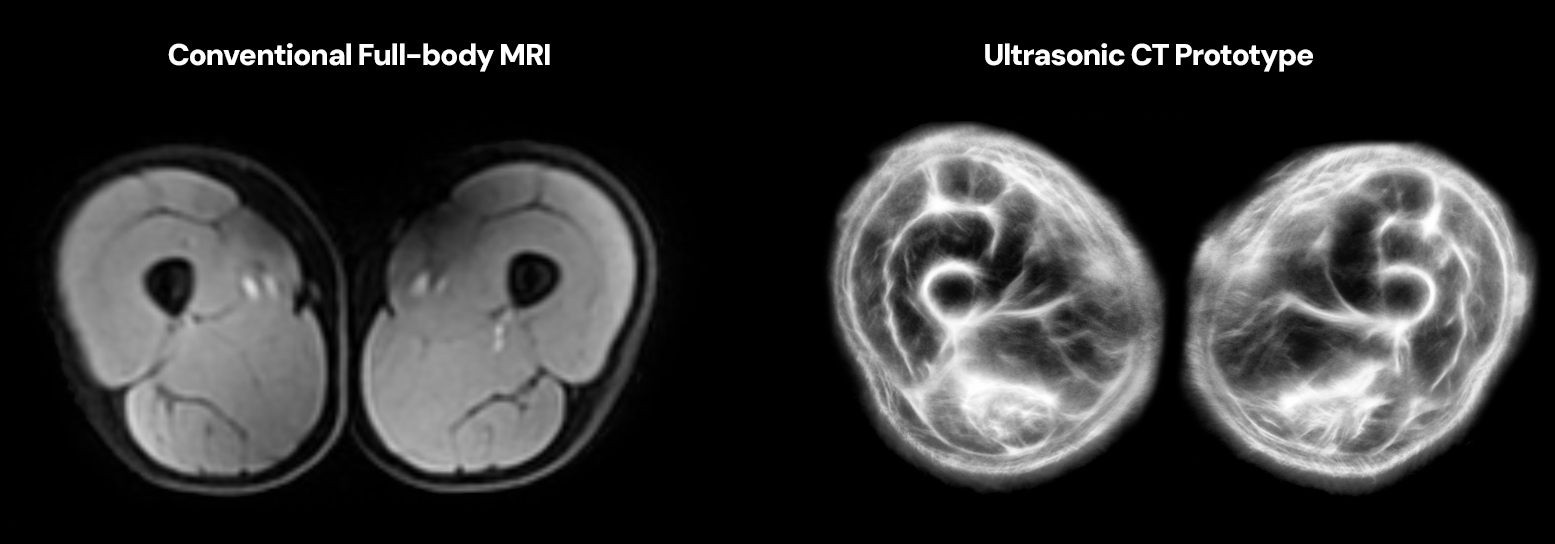 Порівняння реконструкції Ultrasonic CT з МРТ тієї ж ділянки